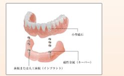 �}�O�l�b�g�{���ꎕ
