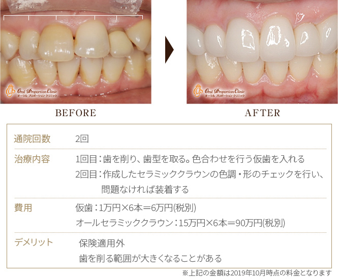 BEFORE→AFTER