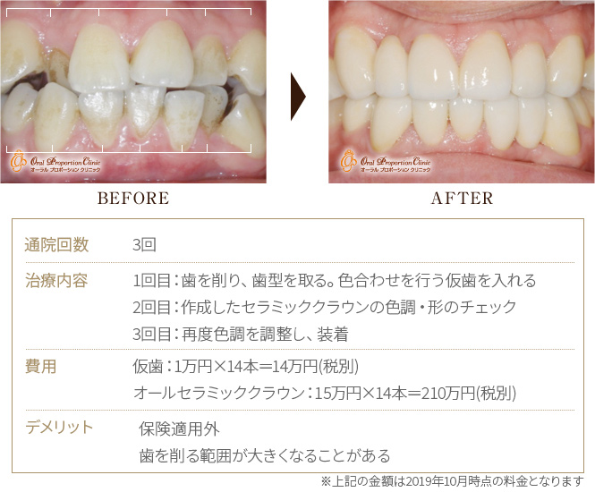 BEFORE→AFTER