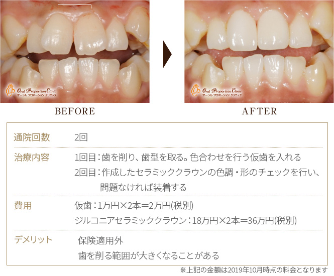 BEFORE→AFTER