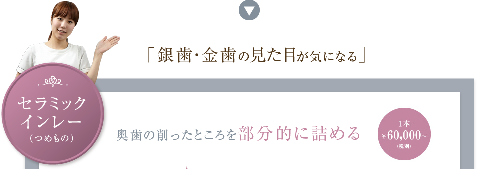 セラミックインレー（つめもの）　「銀歯・金歯の見た目が気になる」　奥歯の削ったところを部分的に詰める　1本60,000円（税別）から