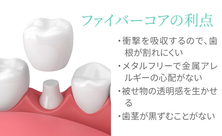 ファイバーコアの利点